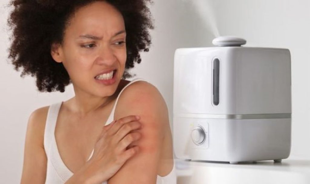5 Best Humidifiers for Eczema - Your Skin Will Be Grateful (Winter 2023)